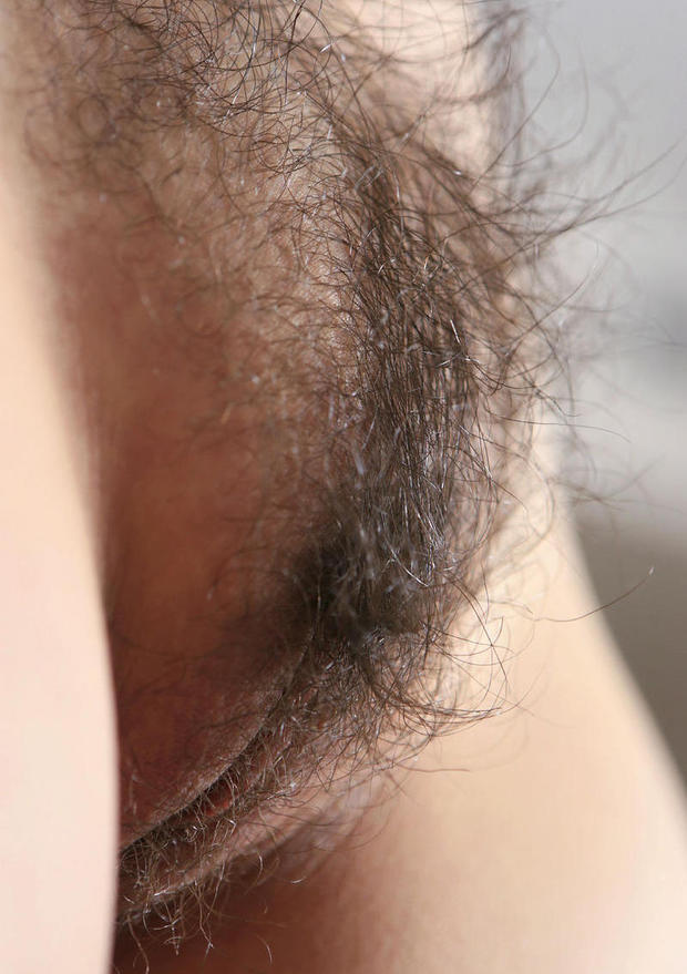 ; Hairy 